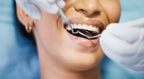 Best Emergency Dentist for Lost Fillings or Crowns in Red Hill, SC