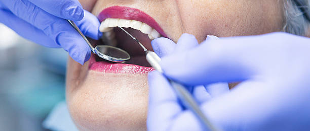 Best Broken or Cracked Tooth Emergency Dentist in Red Hill, SC